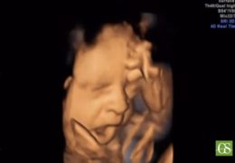 foetus-bailler-photo-echographie